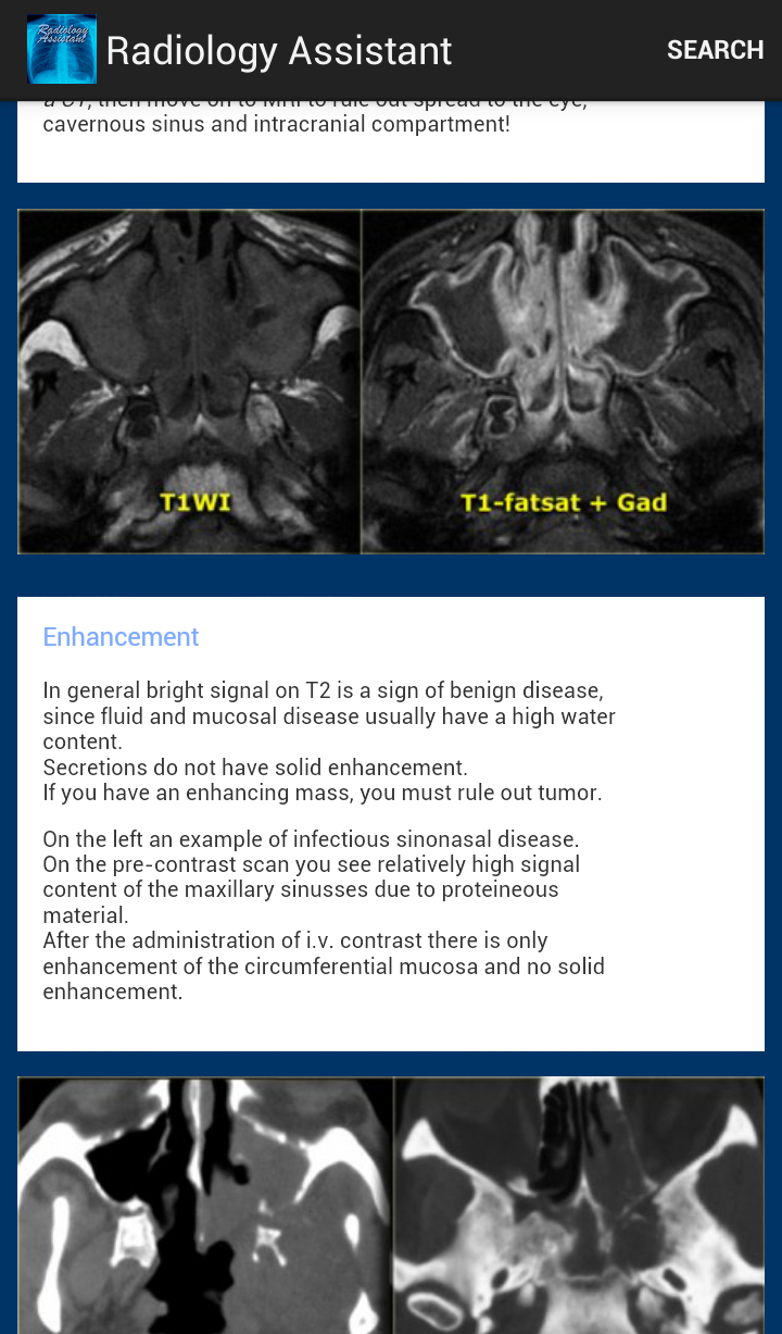 Android application Radiology Assistant screenshort