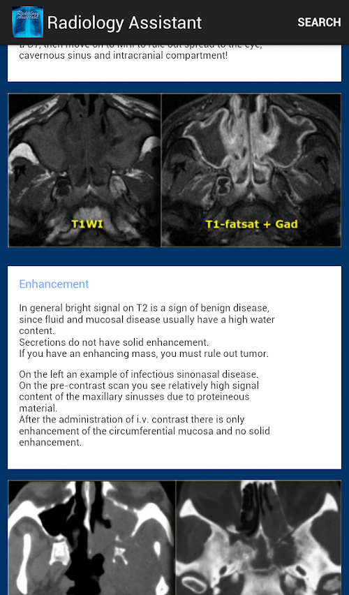 Android application Radiology Assistant screenshort