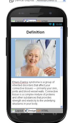 Ehlers Danlos Syndrome Diseaseのおすすめ画像2