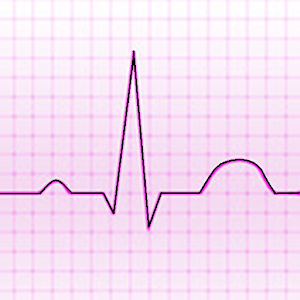 Electrocardiograma ECG Tipos 醫療 App LOGO-APP開箱王