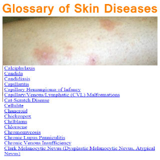 Skin Disease Glossary