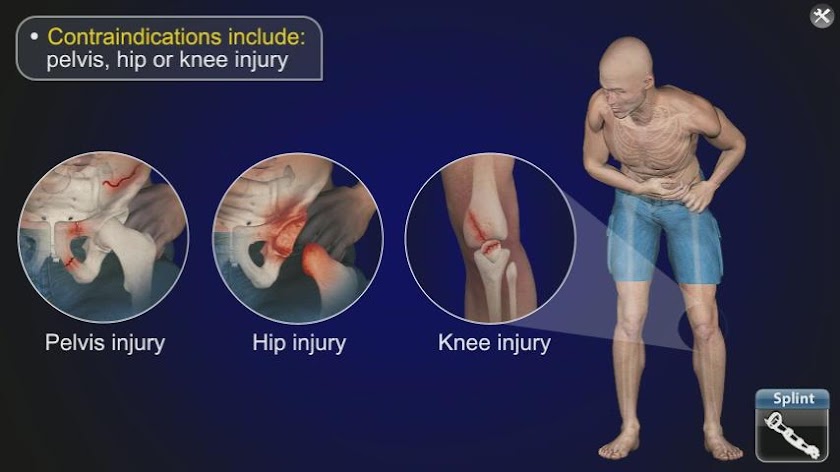 Medrills: Fracture Screen 3