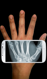How to get Xray Scanner Prank 2.0 apk for laptop