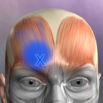 Muscle Trigger Point Anatomy APKs for PC