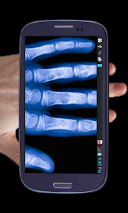 Xray- Prank Screenshots 6