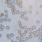 Didymium sp (crystal-head) spores
