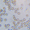 Didymium sp (crystal-head) spores