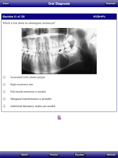 NBDE II Stanford Review Course