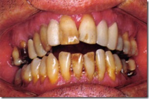 medicina-periodontal