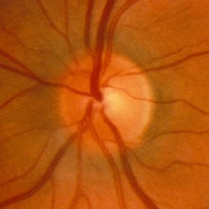 Ophthalmology logo