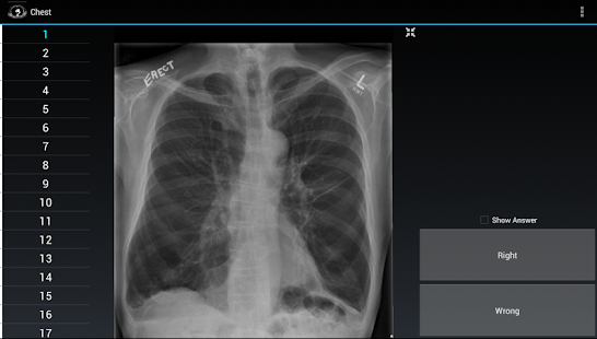 How to mod Radiology Flashcards: Free patch 1.4 apk for pc