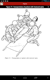 Bandaging and Splinting Screenshots 22