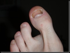 P9130136