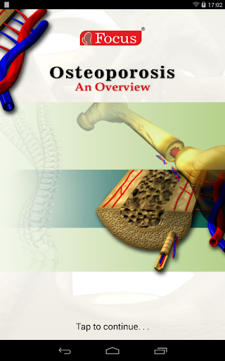 Osteoporosis-An Overview