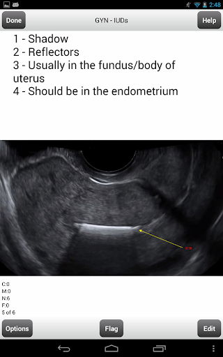 【免費教育App】ARDMS Ultrasound Flashcards Lt-APP點子