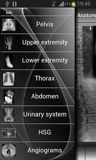 【免費教育App】Human X-ray Anatomy-APP點子