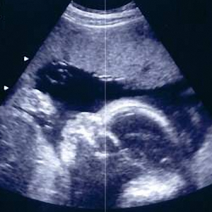 Pregnancy Today & Baby Kick logo