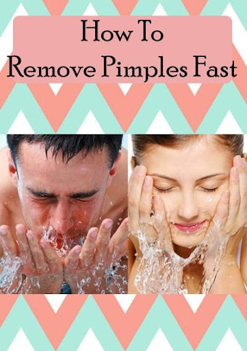 How To Remove Pimples Fast