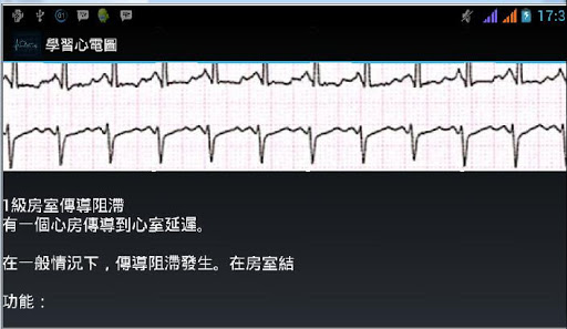 【免費醫療App】學習心電圖-APP點子