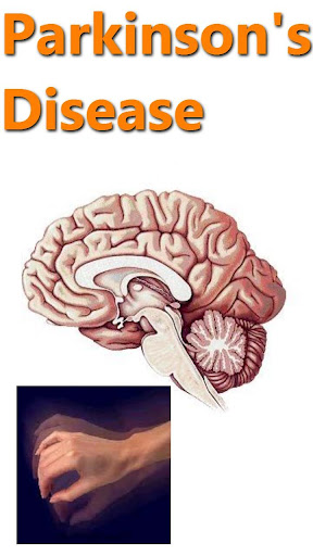 Parkinson's Disease HowTo