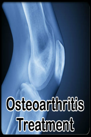 Osteoarthritis Treatment