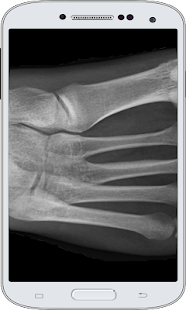 X-Ray Scanner Screenshots 0