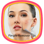 Pimple Remover Tips Apk