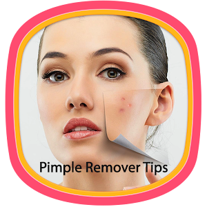 Pimple Remover Tips  Icon
