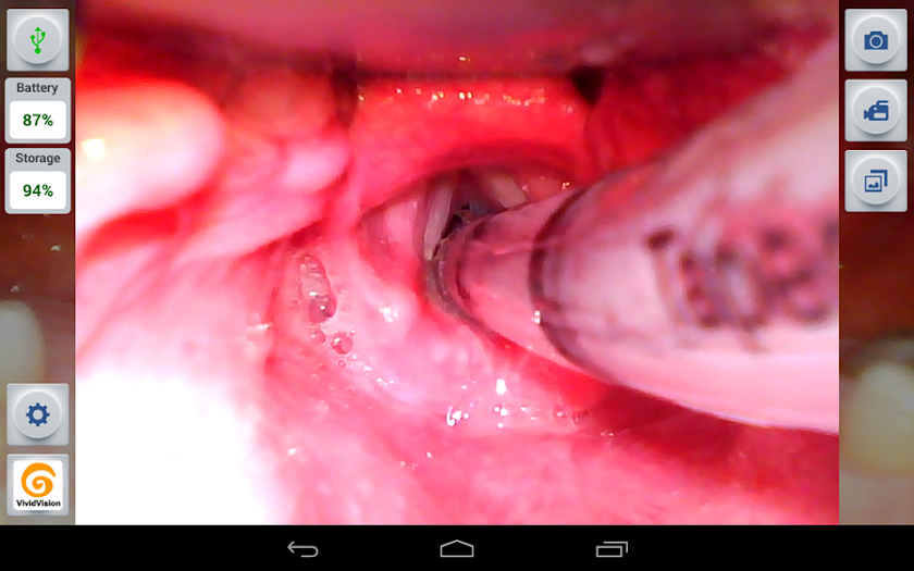 VividVision Screen 2