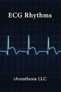 ecg rhythms the ekg guide app是什麼 - APP試玩 - 傳說中的挨踢部門