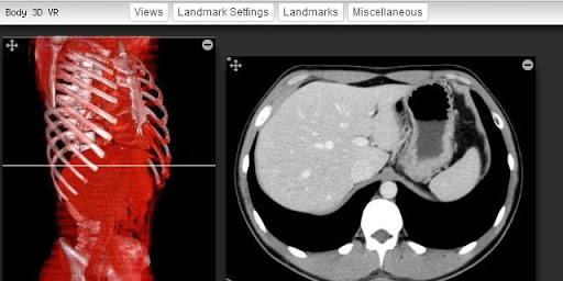 【免費工具App】Imaging Anatomy-APP點子