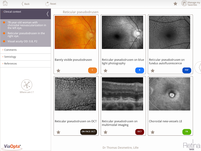 Retina Base Screen 2