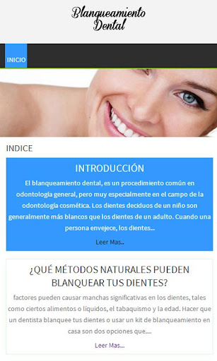 Blanqueamiento dental Guía