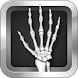 Wrist Repair