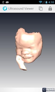 How to mod Ultrasound Viewer lastet apk for android