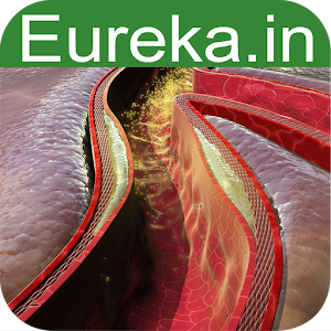 Atherosclerosis 1.6