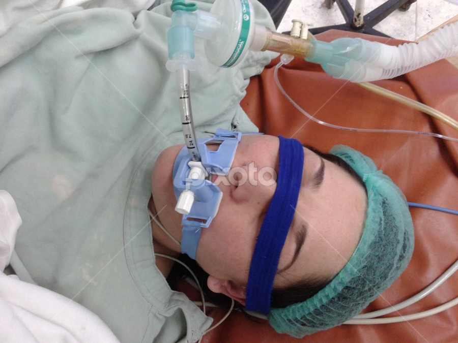 Endotracheal tube holder in use | Group/Corporate | People | Pixoto