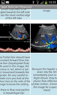 How to get Upper Abdominal Ultrasound 1.0 unlimited apk for android