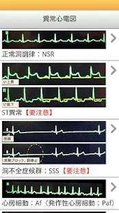 iNurse Tools 異常心電図