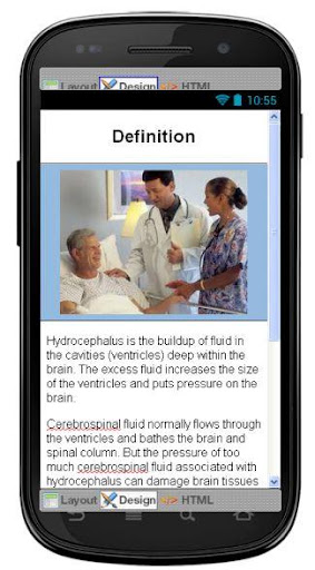 【免費醫療App】Hydrocephalus Information-APP點子