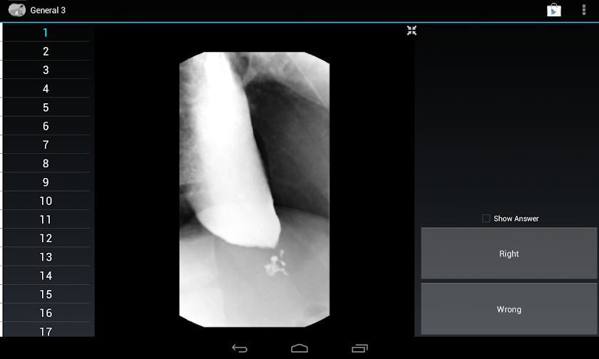 Radiology Flashcards: General3 Screen 3