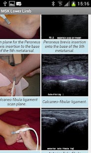 How to mod MSK ultrasound Lower Limb lastet apk for bluestacks