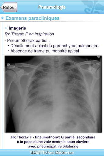 【免費醫療App】SMARTfiches Pneumologie-APP點子