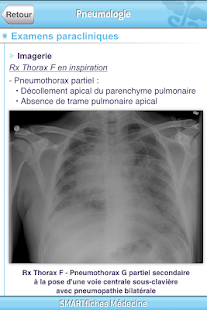 How to download SMARTfiches Pneumologie patch 1.01 apk for pc