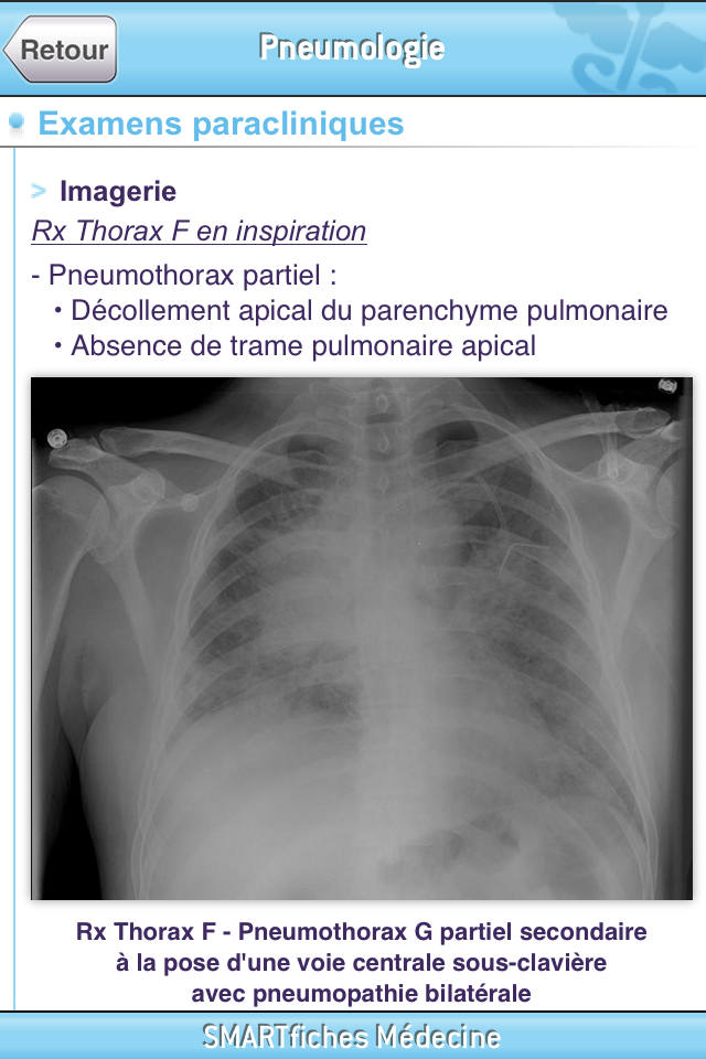 SMARTfiches Pneumologie Screen 2