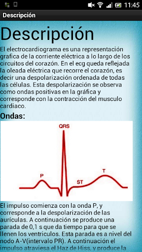 【免費醫療App】Electrocardiograma-APP點子