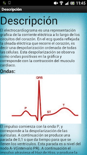 Electrocardiograma