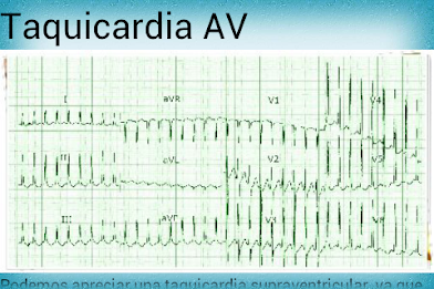 Electrocardiograma PRO poster 20