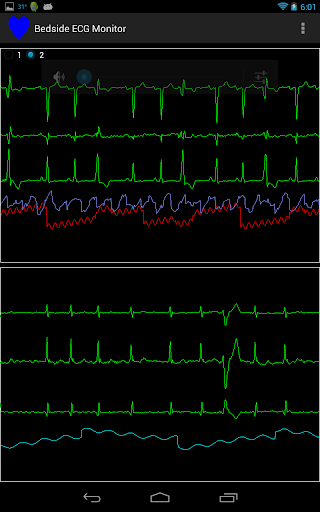 Bedside ECG Monitor