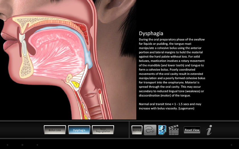 Swallowing Oral Screen 3